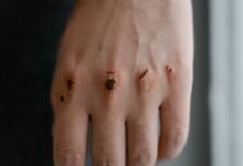 qexilkizmor sensitive skin safety