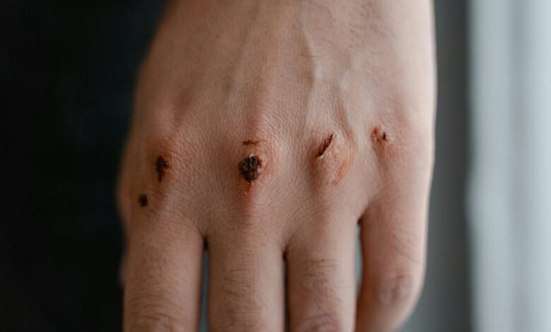 qexilkizmor sensitive skin safety