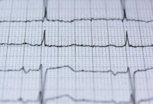 hyper pulse 699215560 strategic ladder